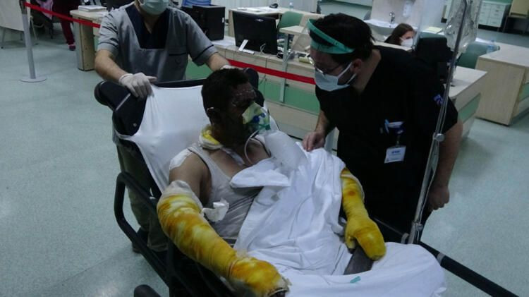 Samsun bu olayı konuşuyor ailesi için kendini riske attı bu hale geldi - Resim: 3