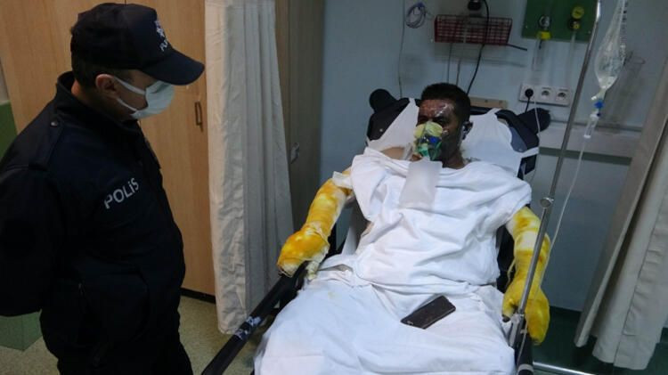 Samsun bu olayı konuşuyor ailesi için kendini riske attı bu hale geldi - Resim: 1