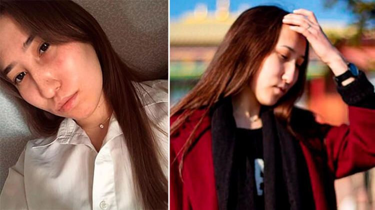 Genç kız kabusu yaşadı yüzünde sadece gözleri kaldı! Korkunç halde bulundu - Resim: 1