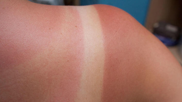 Demlikte kalan çayları değerlendirme yöntemleri - Resim: 3