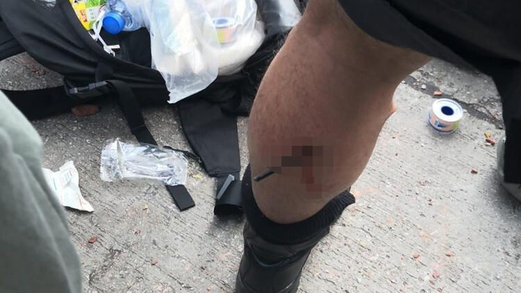 Hong Kong'da göstericiler ateşli oklarla saldırdı korkunç görüntüler - Resim: 2