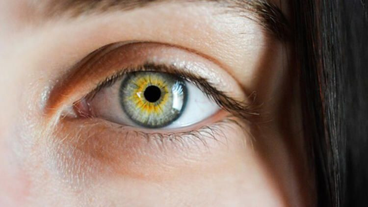 Vücudun verdiği bu sinyallere dikkat eğer sebepsiz morluklar varsa... - Resim: 2