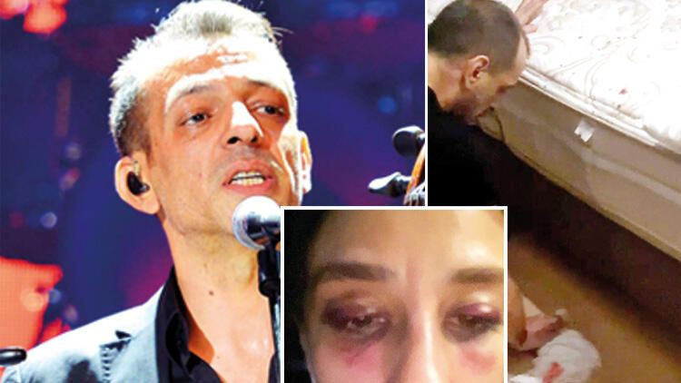 RUBATO'nun solisti Özer Arkun sevgilisini dövdü kan izlerini sildiği görüntüler ortaya çıktı - Resim: 1