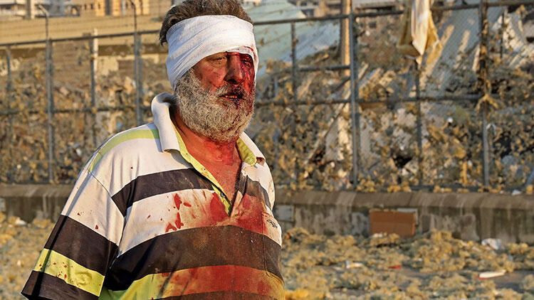 Lübnan'ın başkenti Beyrut'ta büyük patlama! Ölü ve yaralılar var - Resim: 4