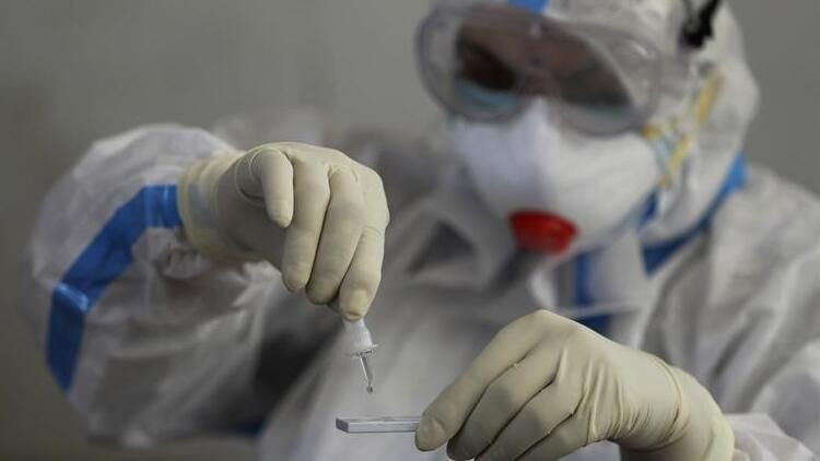 Koronavirüste mucizevi keşif! ABD'li bilim insanları başardı - Resim: 1