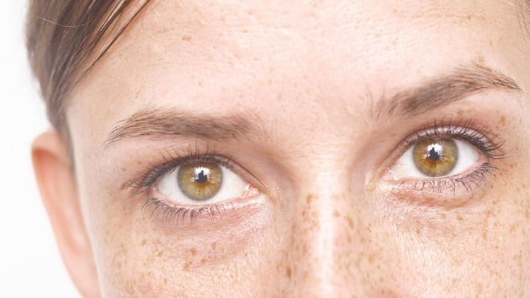 Baharda sık görülen 5 cilt hastalığı! Cildinizde kaşıntı ve kızarıklık varsa... - Resim: 2