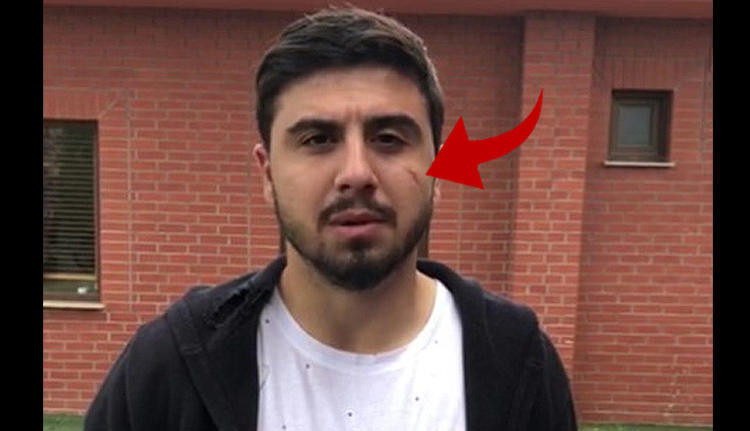 Ozan Tufan sosyal medyaya kızdı benini aldırdı!  - Resim: 3