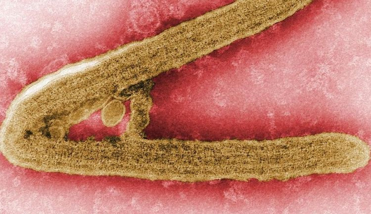 Biri bitmeden biri başlıyor! Şimdi de Marburg virüsü paniği başladı! - Resim: 2