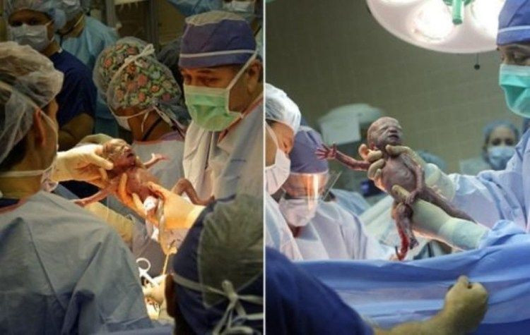 Dünya rekoru kırdı 9 dakikada 6 bebek dünyaya getirdi - Resim: 4