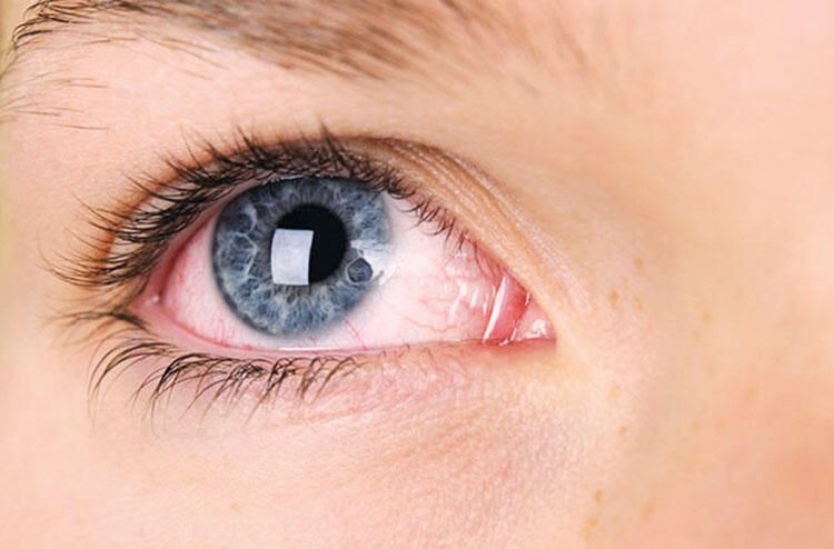 Koronavirüsün hiç bilinmeyen bir belirtisi keşfedildi gözden anlarsınız - Resim: 3