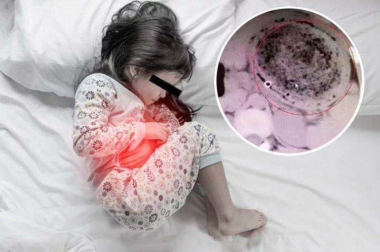 Karın ağrısıyla hastaneye kaldırıldı midesinden çıkanlar şoke etti - Resim: 1