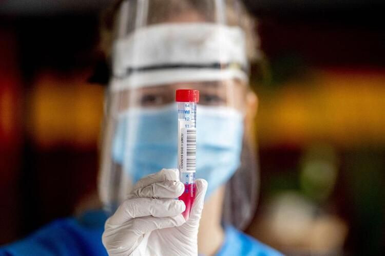 Korona ilacı bulundu! 40 liralık ilaç ne zaman piyasaya çıkacak - Resim: 2