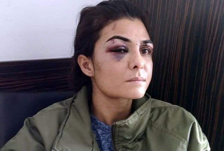 Melek İpek’in 112 görevlisiyle görüşmesi ortaya çıktı! "Kocamı vurdum, çabuk yetişin" - Resim: 2