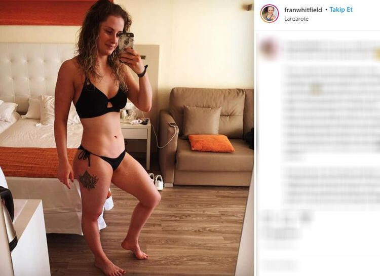 İngiltere'de genç kadın spor yaparken hayatının şokunu yaşadı - Resim: 3