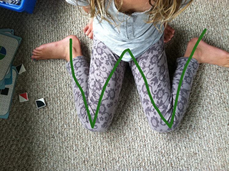 Çocuğunuz böyle oturuyorsa dikkat çok geç olmadan durdurun - Resim: 4