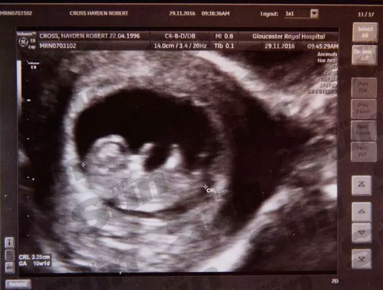 20 yaşındaki genç adam 4 aylık hamile inanılmaz! - Resim: 3