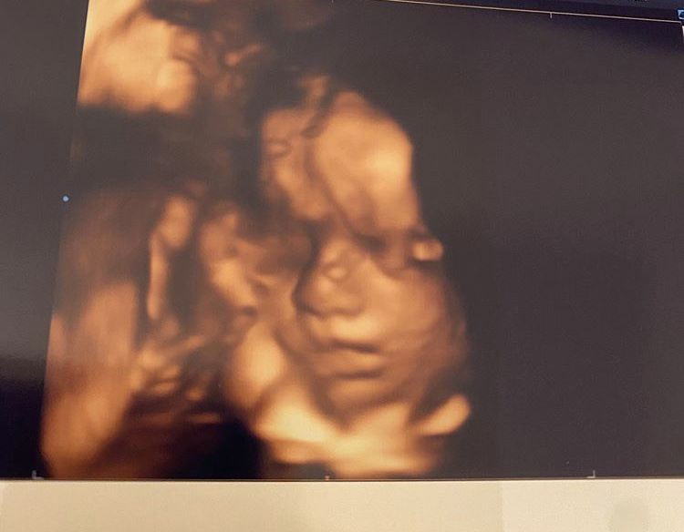 Hamile olan Ceyda Ateş karnı burnunda pozlar paylaştı fiziğiyle büyüledi - Resim: 2