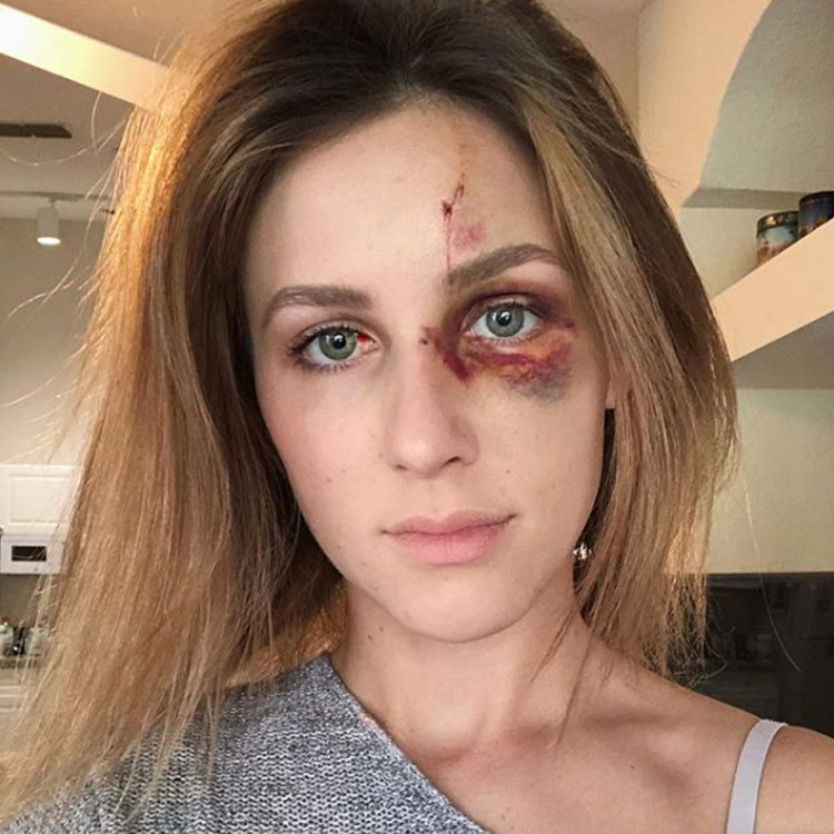 Sevgilisini göğüsleri görünüyor diye komalık etti! Asıl olay ise sonra yaşandı - Resim: 4