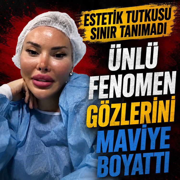 Estetik tutkusu sınır tanımadı! Ünlü fenomen gözlerini maviye boyattı