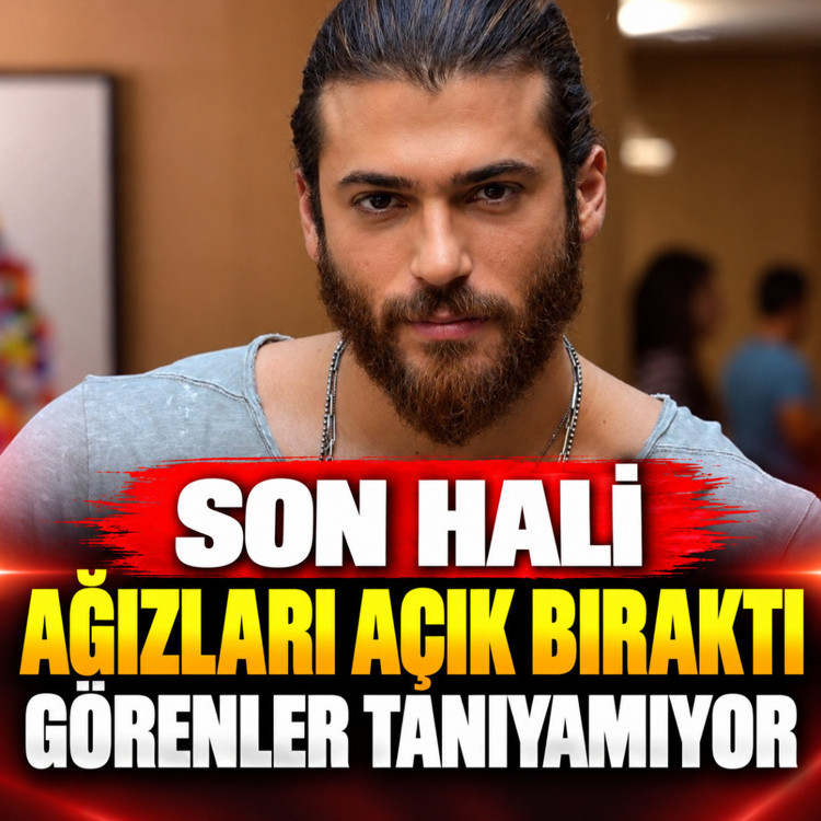 Can Yaman'ın son hali ağızları açık bıraktı! Görenler tanıyamıyor