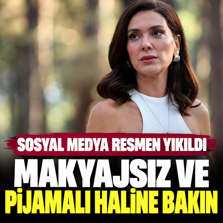 Bergüzar Korel'den makyajsız ve pijamalı paylaşım! Sosyal medya resmen yıkıldı
