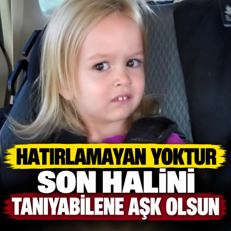 İnternetin efsane bakışlı kızı Chloe büyüdü, şimdiki halini görenler "yok artık" diyor