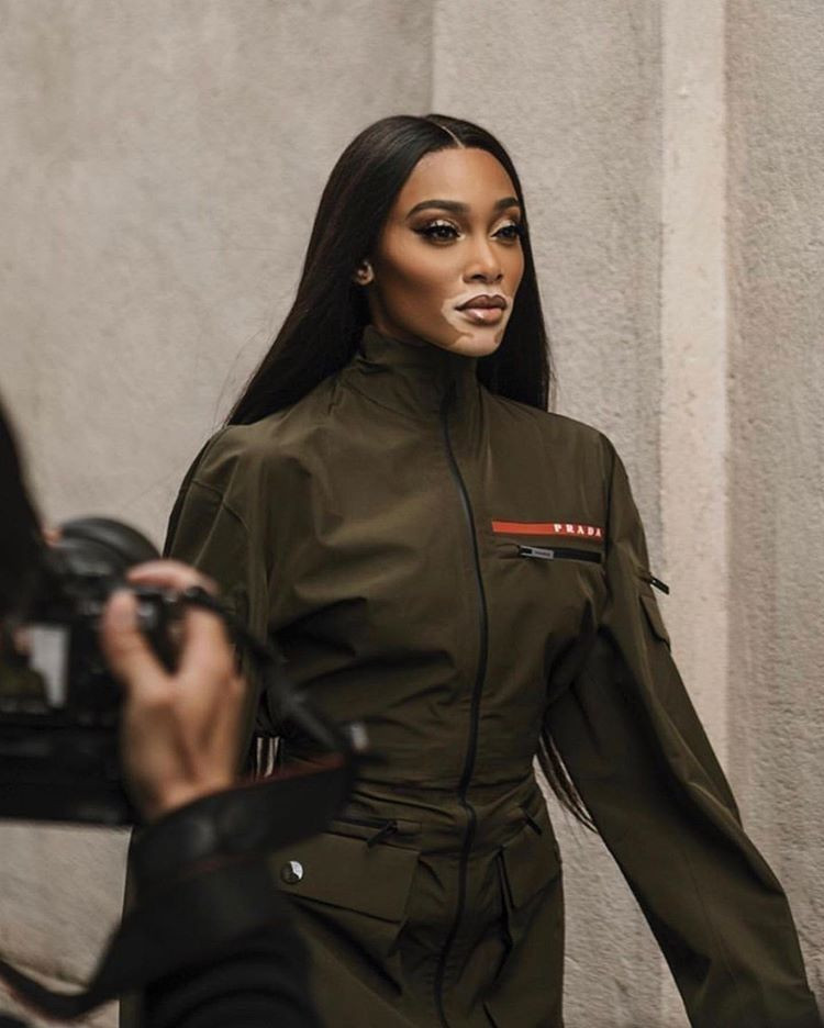 Vitiligo'lu model Winnie Harlow uçak pozu nedeniyle eleştirilere maruz kaldı - Resim: 4