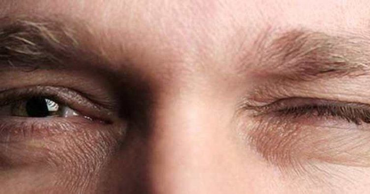 Gözüm seğiriyor neden olabilir işte göz seğirmesinin sebebi! - Resim: 4
