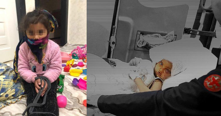 Pitbull saldırısında parçalanan Asiye'ye anne işkencesi! Şok fotoğraflar ortaya çıktı böyle bağlamış! - Resim: 2