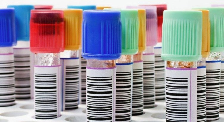 Kan gruplarına göre kanser riskleri - Resim: 4