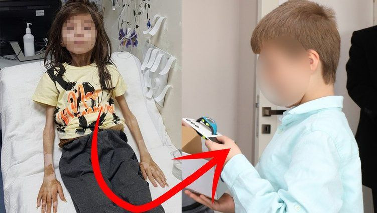 Bursa'da çöp evde bulunmuştu! Küçük Muhammet'in son hali sevindirdi: Kilo aldı, isteği gülümsetti! - Resim: 1