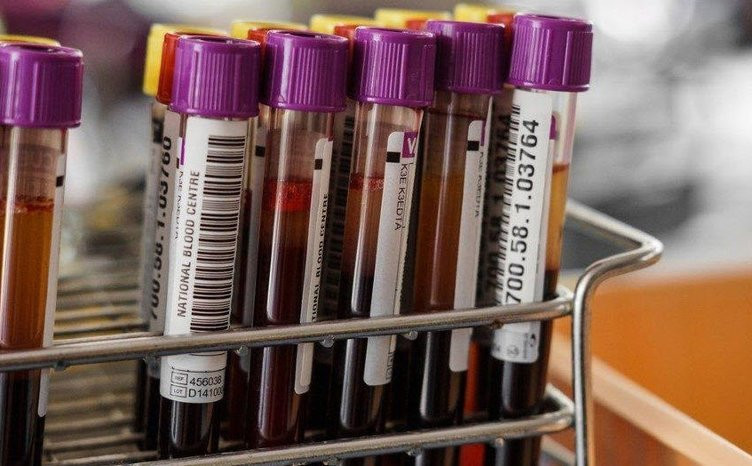 Kan gruplarına göre kanser riskleri - Resim: 2