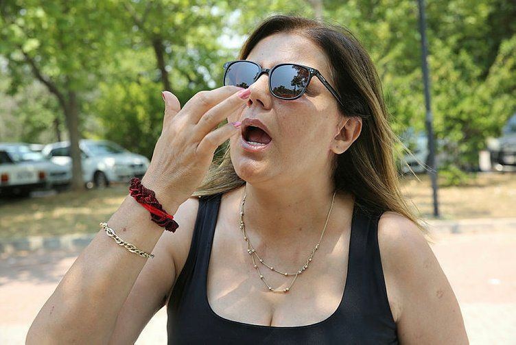 Bir estetik faciası daha! Burun kemikleri eriyip genzinden düştü - Resim: 4