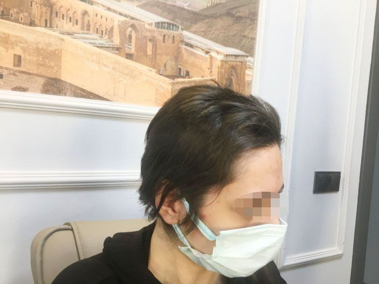 Genç kadını kaçırdıkları rezidansta çırılçıplak soyup videoya aldılar yüzünde sigara söndürdüler - Resim: 2