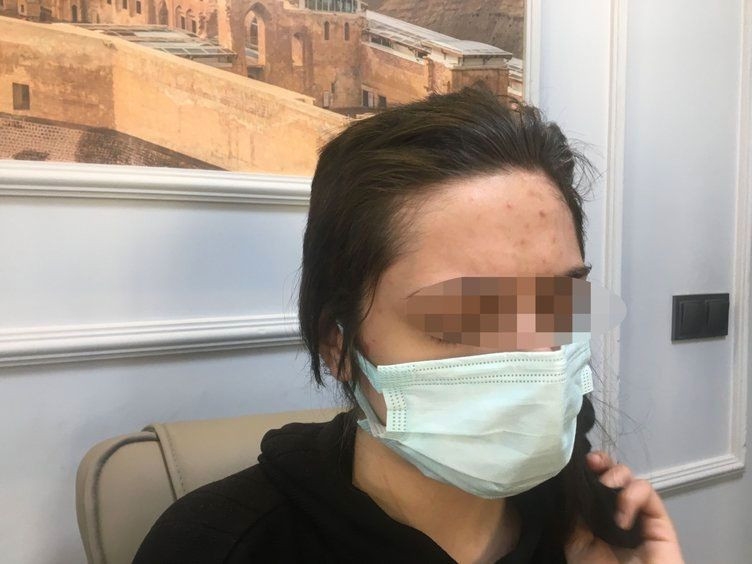 Genç kadını kaçırdıkları rezidansta çırılçıplak soyup videoya aldılar yüzünde sigara söndürdüler - Resim: 3