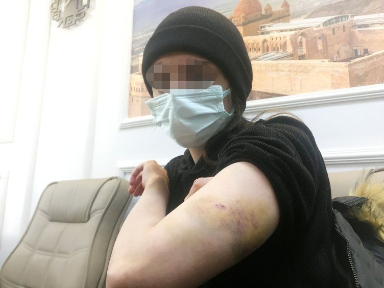 Rezidansta kadınlara işkence Adli Tıp raporunda! Okuyanın kanı donuyor... - Resim: 2