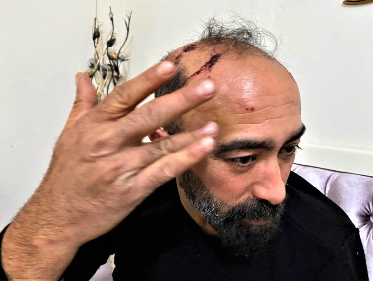 Taksi şoförünün başına kaldırım taşıyla vurmuştu! O caninin ifadesi yok artık dedirtti - Resim: 1