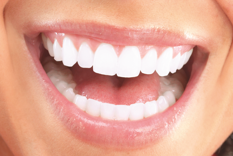 Ağız kokusu neden olur bakın kokunun sebepleri neymiş! - Resim: 1