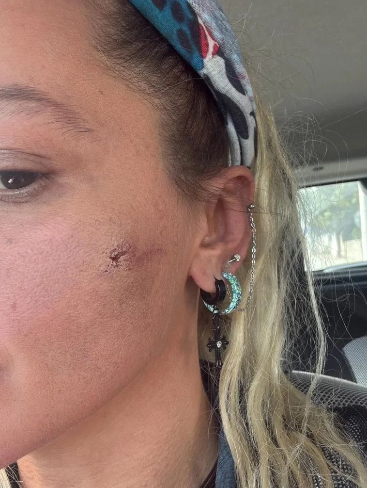 8 ay önce evlenmişti! Yıldız Asyalı eşi tarafından darp edildi fotoğraf paylaştı - Resim: 3