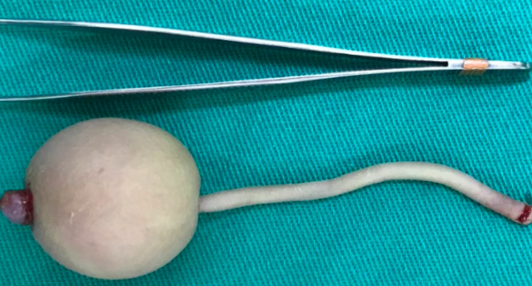 Milyonda bir görünüyor! Doktorlar bile donup kaldı! Böyle bir şey nasıl olur? - Resim: 2