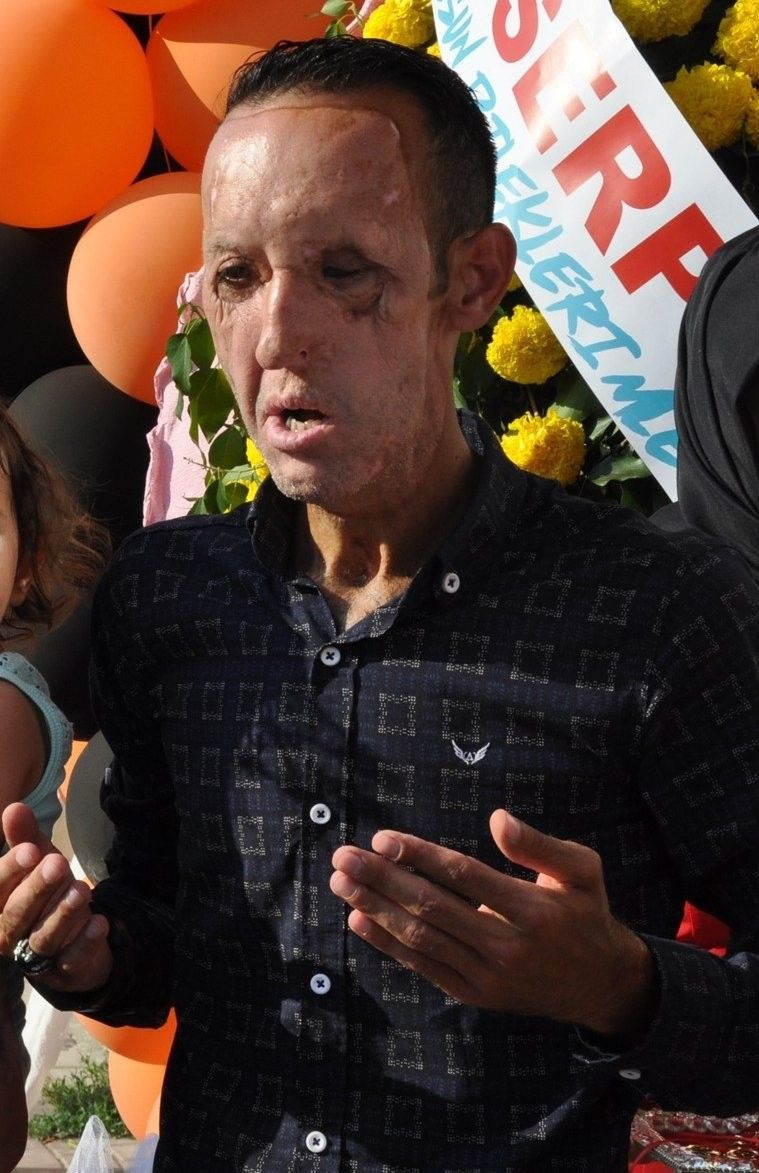 Yüz nakli yapılan Recep Sert gözaltına alındı - Resim: 3