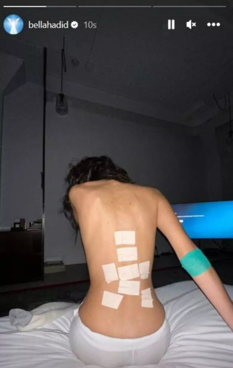 Dünyaca ünlü model Bella Hadid hastanelik oldu sebebini duyanlar şaştı kaldı! - Resim: 3