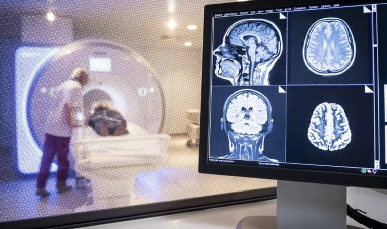 Tıp tarihinde bir ilk 32 yaşında girdiği komadan 59 yaşında uyandı! - Resim: 2