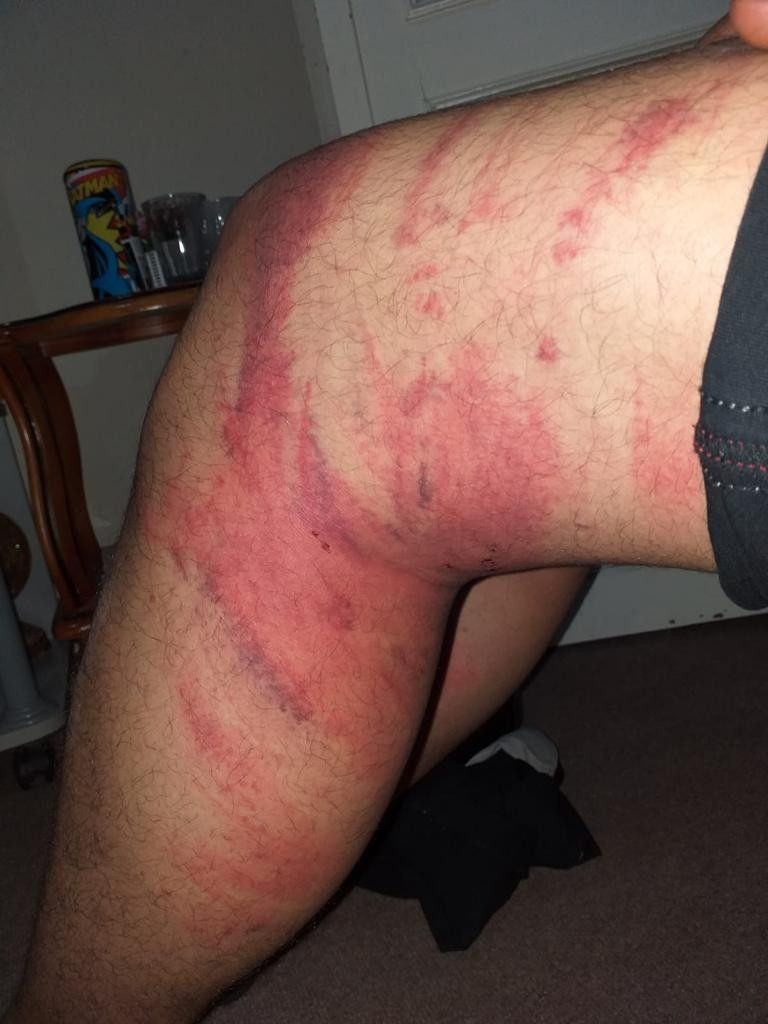 Konya'da çırağını triger kayışıyla döven usta tutuklandı - Resim: 3