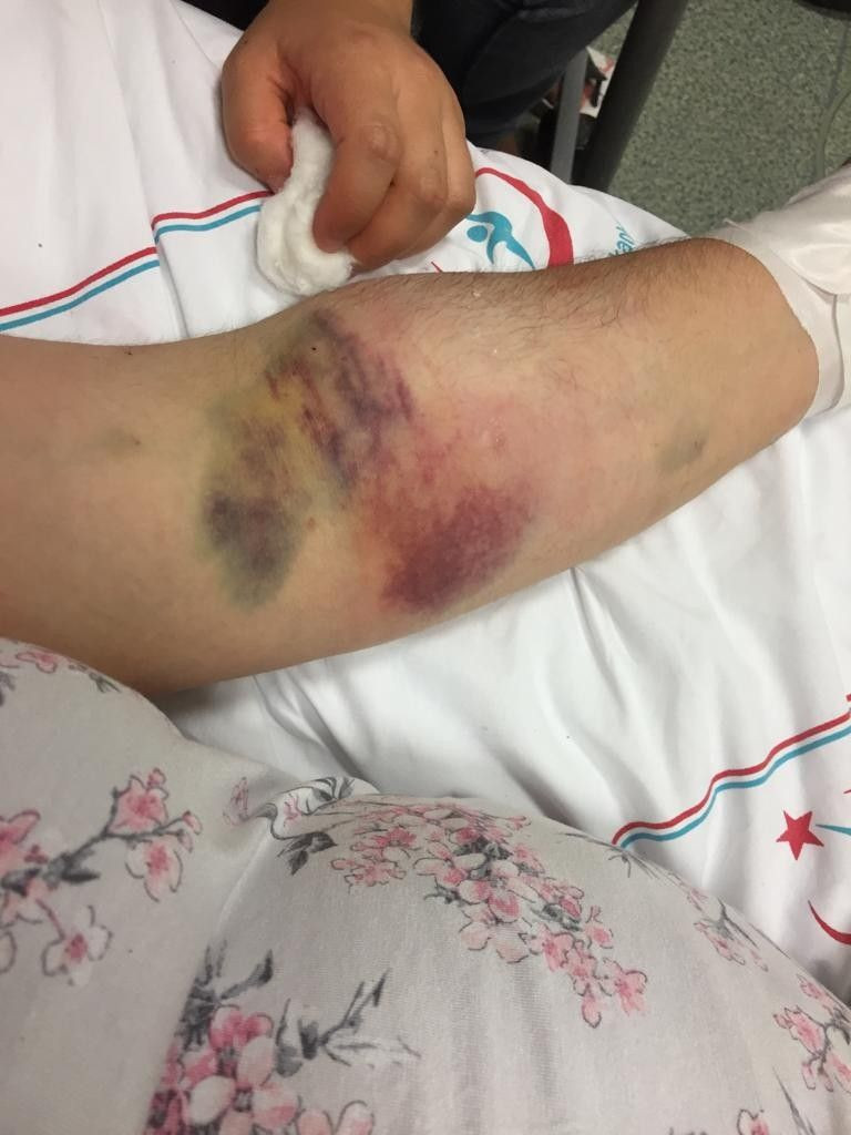 Karısını 21 yerinden bıçakladı! Mahkemede onu seviyorum diyerek şoke etti - Resim: 4