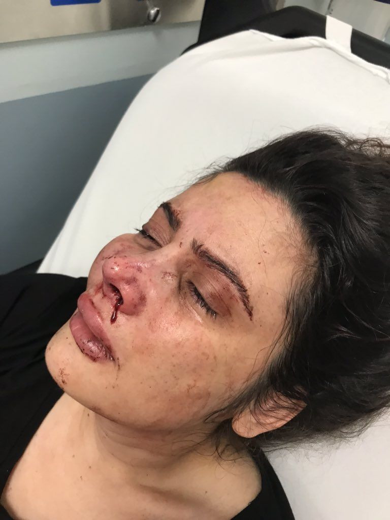 Derya Elbasan eşi tarafından feci şekilde dövüldü! Kızı Hira Elbasan isyan etti - Resim: 2