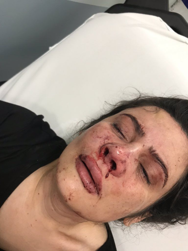 Derya Elbasan eşi tarafından feci şekilde dövüldü! Kızı Hira Elbasan isyan etti - Resim: 3