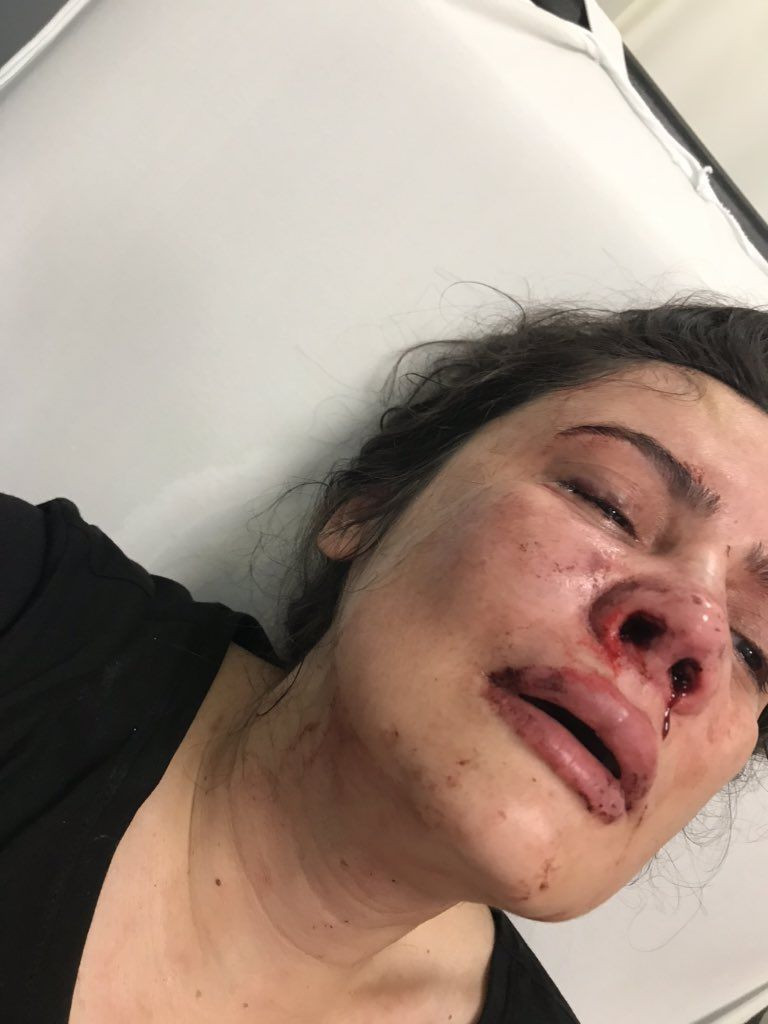 Derya Elbasan eşi tarafından feci şekilde dövüldü! Kızı Hira Elbasan isyan etti - Resim: 4