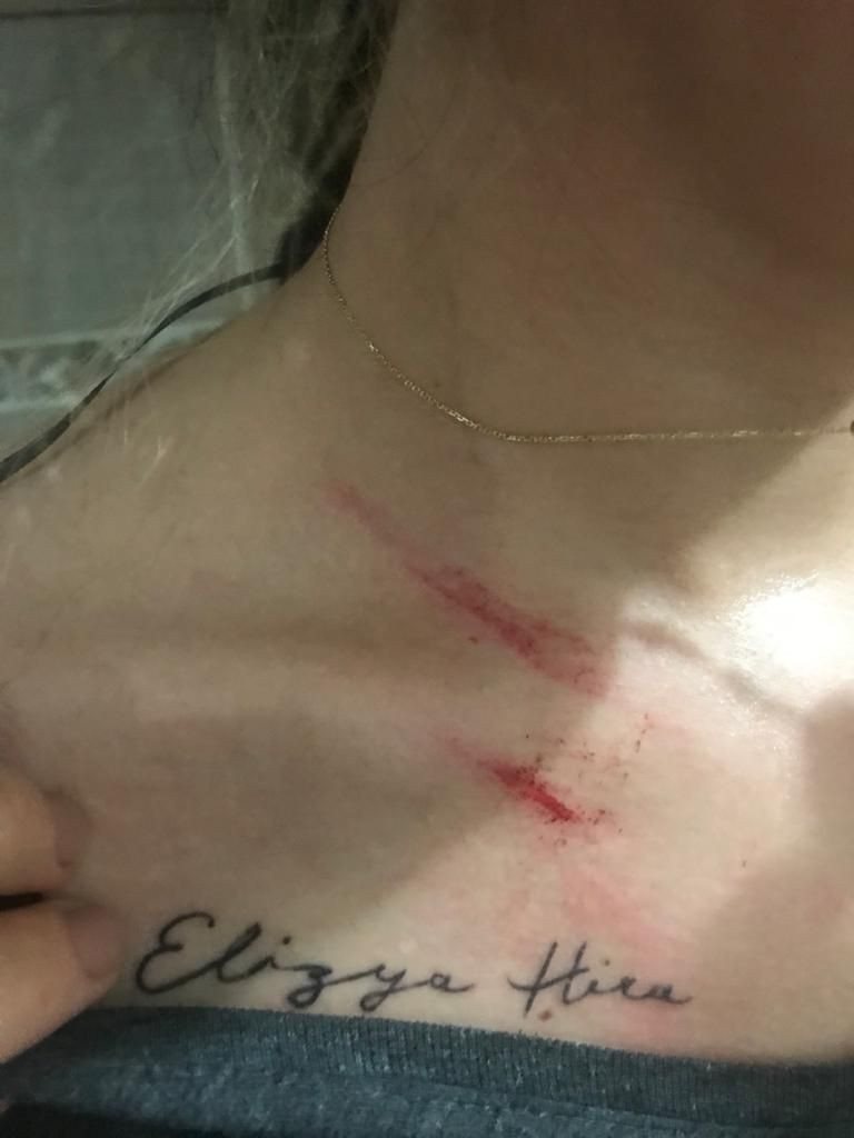 Balayından beri dövüyordu Mersin'de dayakçı koca dehşeti! - Resim: 3