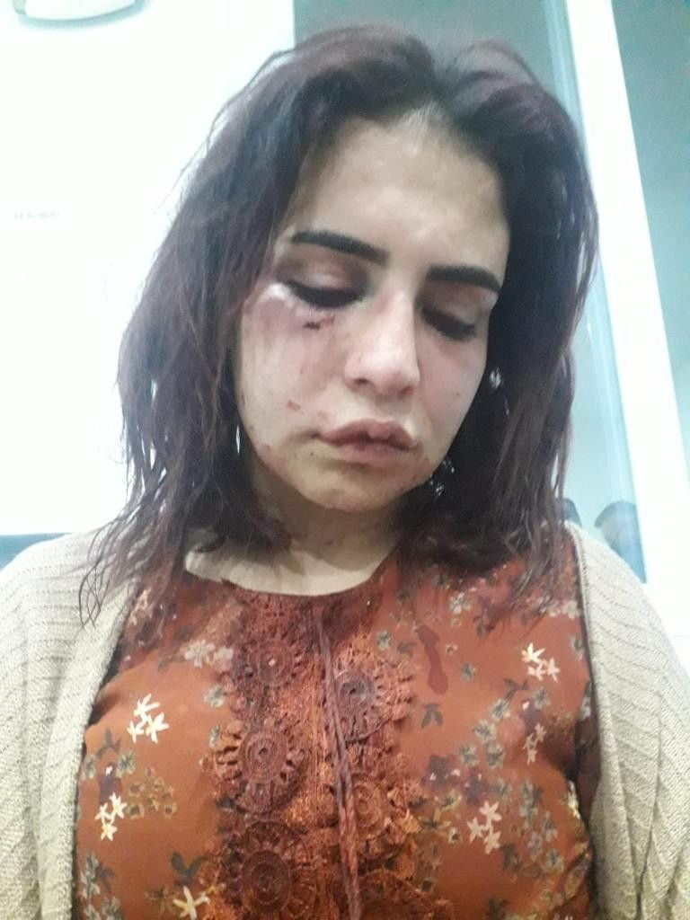 Antalya'da eski sevgilisi dehşeti yaşatıp öldü diye bıraktı! Paylaşımı Twitter'da gündem oldu - Resim: 2